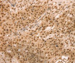 SNX8 Polyclonal Antibody:Antibodies, Polyclonal