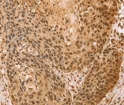 SNX8 Polyclonal Antibody:Antibodies, Polyclonal
