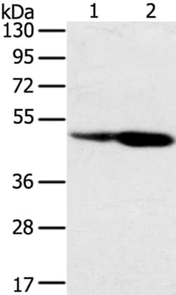 Invitrogen SNX8 Polyclonal Antibody 100 &mu;L | Buy Online | Invitrogen&trade; | Fisher Scientific