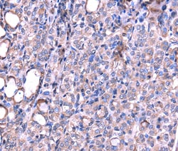 Invitrogen SRPK3 Polyclonal Antibody 100 &mu;L | Buy Online | Invitrogen&trade; | Fisher Scientific