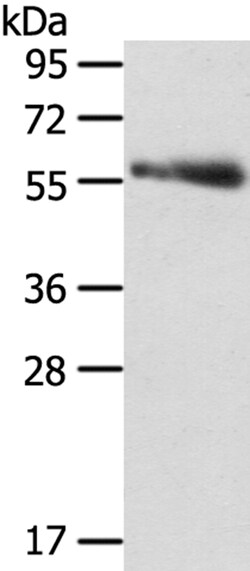 Invitrogen SRPK3 Polyclonal Antibody 100 &mu;L | Buy Online | Invitrogen&trade; | Fisher Scientific