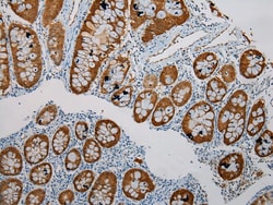 Invitrogen SULT1B1 Polyclonal Antibody 100 &mu;L; Unconjugated:Antibodies,