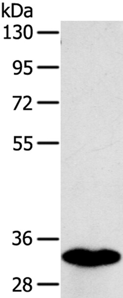 Invitrogen SULT1B1 Polyclonal Antibody 100 &mu;L | Buy Online | Invitrogen&trade; | Fisher Scientific