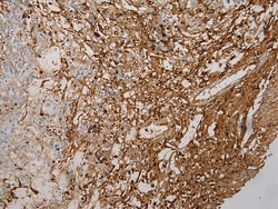 Invitrogen STX18 Polyclonal Antibody 100 &mu;L; Unconjugated:Antibodies,