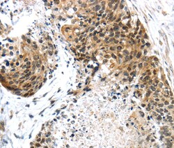 Invitrogen TRIM74 Polyclonal Antibody 100 &mu;L; Unconjugated:Antibodies,