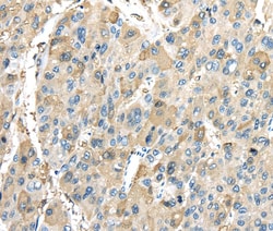 Invitrogen INHBB Polyclonal Antibody 100 &mu;L; Unconjugated:Antibodies,