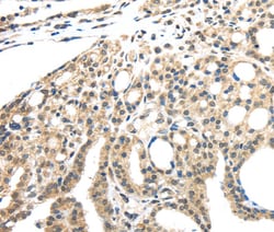 Invitrogen INHBB Polyclonal Antibody 100 &mu;L; Unconjugated:Antibodies,
