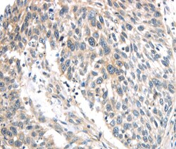Invitrogen IQGAP2 Polyclonal Antibody 100 &mu;L | Buy Online | Invitrogen&trade; | Fisher Scientific