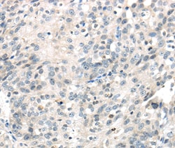 Invitrogen IQGAP2 Polyclonal Antibody 100 &mu;L | Buy Online | Invitrogen&trade; | Fisher Scientific