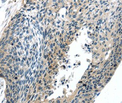 Invitrogen BOK Polyclonal Antibody 100 &mu;L; Unconjugated:Antibodies,