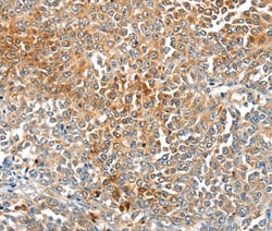 Invitrogen MAGEB2 Polyclonal Antibody 100 &mu;L; Unconjugated:Antibodies,