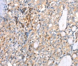 Invitrogen MAGEB2 Polyclonal Antibody 100 &mu;L; Unconjugated:Antibodies,
