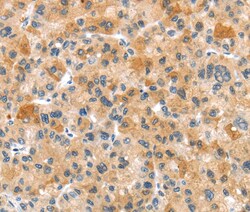 Invitrogen RHCG Polyclonal Antibody 100 &mu;L; Unconjugated:Antibodies,