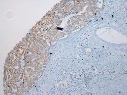 Invitrogen SLC6A19 Polyclonal Antibody 100 &mu;L; Unconjugated:Antibodies,
