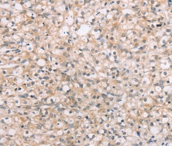 Invitrogen ROR1 Polyclonal Antibody 100 &mu;L | Buy Online | Invitrogen&trade; | Fisher Scientific