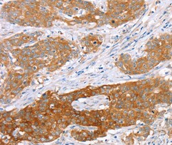 Invitrogen SUR1 Polyclonal Antibody 100 &mu;L; Unconjugated:Antibodies,