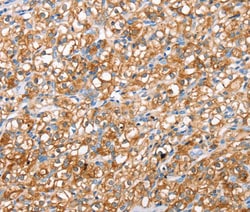 Invitrogen SUR1 Polyclonal Antibody 100 &mu;L; Unconjugated:Antibodies,