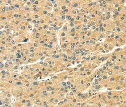 Invitrogen THAP3 Polyclonal Antibody 100 &mu;L; Unconjugated:Antibodies,