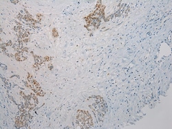 Invitrogen Thrombospondin 2 Polyclonal Antibody 100 &mu;L; Unconjugated:Antibodies,