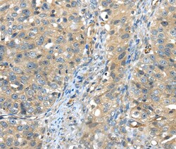 Invitrogen ISM2 Polyclonal Antibody 100 &mu;L; Unconjugated:Antibodies,