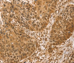 Invitrogen VMP1 Polyclonal Antibody 100 &mu;L; Unconjugated:Antibodies,