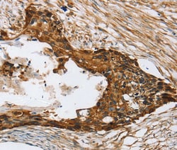 Invitrogen TPD52L2 Polyclonal Antibody 100 &mu;L; Unconjugated:Antibodies,