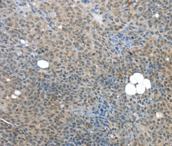 Invitrogen PCQAP Polyclonal Antibody 100 &mu;L; Unconjugated:Antibodies,