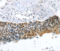 Invitrogen TREF1 Polyclonal Antibody 100 &mu;L; Unconjugated:Antibodies,