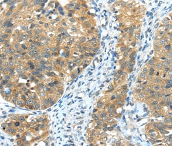 Invitrogen TRIB1 Polyclonal Antibody 100 &mu;L | Buy Online | Invitrogen&trade; | Fisher Scientific