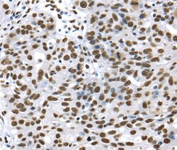 Invitrogen UAP56 Polyclonal Antibody 100 &mu;L; Unconjugated:Antibodies,