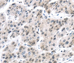 Invitrogen UAP56 Polyclonal Antibody 100 &mu;L; Unconjugated:Antibodies,