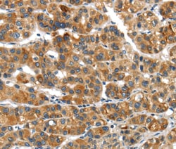 Invitrogen UBAP2 Polyclonal Antibody 100 &mu;L; Unconjugated:Antibodies,
