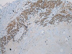 Invitrogen UTS2B Polyclonal Antibody 100 &mu;L; Unconjugated:Antibodies,
