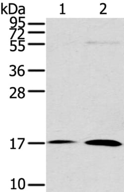 Invitrogen UTS2B Polyclonal Antibody 100 &mu;L | Buy Online | Invitrogen&trade; | Fisher Scientific
