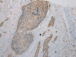 Invitrogen VPS36 Polyclonal Antibody 100 &mu;L; Unconjugated:Antibodies,