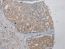 Invitrogen VPS36 Polyclonal Antibody 100 &mu;L; Unconjugated:Antibodies,