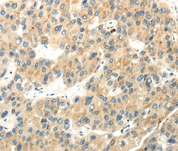 Invitrogen WDR36 Polyclonal Antibody 100 &mu;L; Unconjugated:Antibodies,
