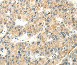 WDR36 Polyclonal Antibody, Invitrogen 100 &mu;L; Unconjugated:Antibodies,