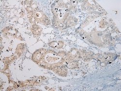 Invitrogen RASSF3 Polyclonal Antibody 100 &mu;L; Unconjugated:Antibodies,