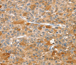 Invitrogen RIPK5 Polyclonal Antibody 100 &mu;L; Unconjugated:Antibodies,