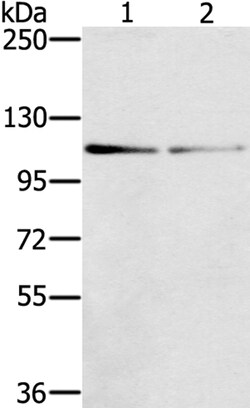 Invitrogen RIPK5 Polyclonal Antibody 100 &mu;L | Buy Online | Invitrogen&trade; | Fisher Scientific