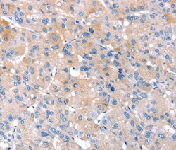 Invitrogen RNF214 Polyclonal Antibody 100 &mu;L; Unconjugated:Antibodies,
