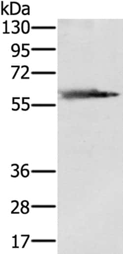 Invitrogen PMAT Polyclonal Antibody 100 &mu;L | Buy Online | Invitrogen&trade; | Fisher Scientific