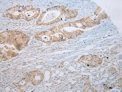 Invitrogen SSBP4 Polyclonal Antibody 100 &mu;L; Unconjugated:Antibodies,