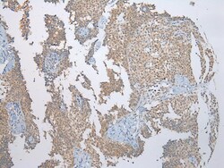 Invitrogen SSBP4 Polyclonal Antibody 100 &mu;L; Unconjugated:Antibodies,