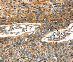 Invitrogen STX19 Polyclonal Antibody 100 &mu;L; Unconjugated:Antibodies,