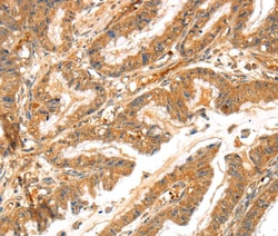 Invitrogen LPP Polyclonal Antibody 100 &mu;L; Unconjugated:Antibodies,