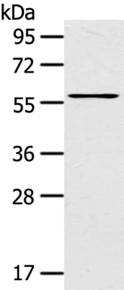 Invitrogen LPP Polyclonal Antibody 100 &mu;L; Unconjugated:Antibodies,