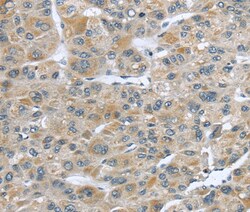 Invitrogen CCDC19 Polyclonal Antibody 100 &mu;L; Unconjugated:Antibodies,