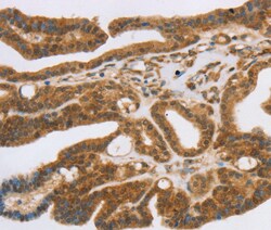 Invitrogen SLC7A9 Polyclonal Antibody 100 &mu;L; Unconjugated:Antibodies,